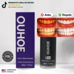 OUHOE® v34 - Blanqueamiento de nivel profesional desde casa